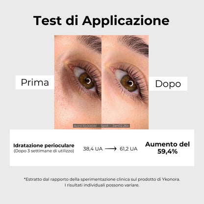 NORALIFT - Patch coreana a microinfusione