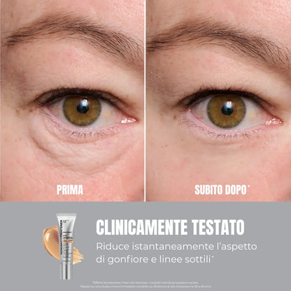 Eye Tightener - Siero Istantaneo Anti-Age