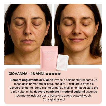 YKONORA - Patch coreana con microaghi