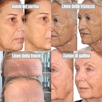 YKONORA - Gel Rassodante Istantaneo